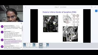 Brachytherapy treatment planning  SCMPCR ELP03  Lecture5 [upl. by Hayarahs]