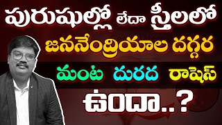 Causes of genital blisters  రషెస్ ట్రీట్ మెంట్  Dr Raza [upl. by Falzetta634]