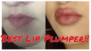 Mejor Aumentador de Labios  Reseña de CandyLipz [upl. by Ysnap]