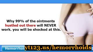 Hemorrhoid Remedy  Get Rid Of Skin Tags From Hemorrhoids [upl. by Vanderhoek205]