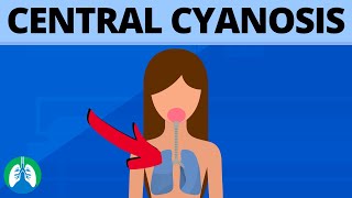 Central Cyanosis Medical Definition  Quick Explainer Video [upl. by Odele]