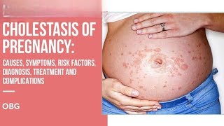 cholestasis in Pregnancy CIP [upl. by Triley]