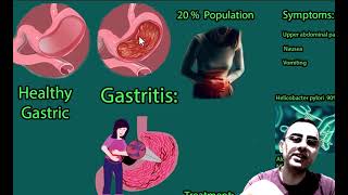 Understanding Gastritis Causes Symptoms and Treatments [upl. by Zap]