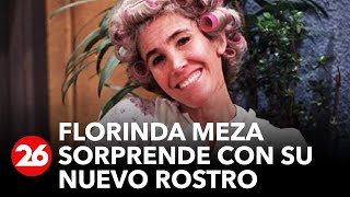 El impactante cambio en el rostro de Doña Florinda [upl. by Hedley]