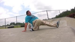 Fat Skater Ankle Dislocation [upl. by O'Donnell]