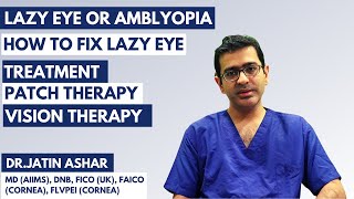 Amblyopia Lazy Eye  Meaning  Treatment of Amblyopia Lazy Eye  Patch amp Vision Therapy Exercise [upl. by Liana]