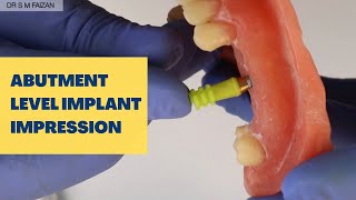 Abutment Level Implant Impression [upl. by Ojoj]