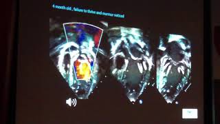 Ecocardiografía  Dr Vitor C Guerra [upl. by Teevens]