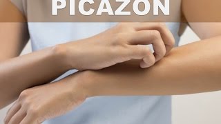 Como reducir la piel con picor o picazón intensa en el cuerpo [upl. by Mellitz273]