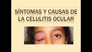 CELULITIS OCULAR  SINTOMAS Y CAUSAS [upl. by Obeng]