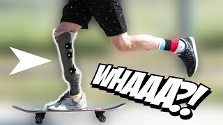 MIND BLOWING Prosthetic Leg Skater [upl. by Acinnej]