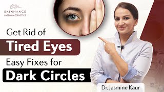 Dark circles under eyes  Get rid of dark circles  Skinhance Clinic [upl. by Queenie465]