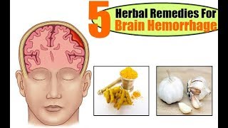 Top 5 Herbal Remedies For Brain Hemorrhage [upl. by Alcine]