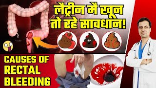 लैट्रीन मै खून आना तो रहे सावधान जाने Poti Mai Khoon Aana के लक्षण  Causes Of Rectal Bleeding Hindi [upl. by Assirrem]