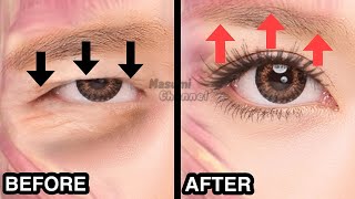 9mins Big Eyes Massage Fast Results  Lift Droopy Eyelids Make Your Eyes Bigger [upl. by Kiersten]