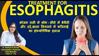 Esophagitis Symptoms Causes amp homeopathic treatment खाना खाने में तकलीफदर्द को ना करें नज़रअंदाज़ [upl. by Etam]