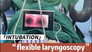 Flexible Laryngoscopy intubation Procedure with BESDATA Disposable Flexible Laryngoscope [upl. by Figge128]