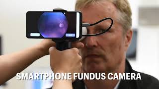 Smartphone Fundus Camera [upl. by Anzovin]