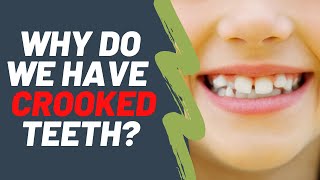 Why do we have crooked teeth  Dentist Explained 2021 [upl. by Godding]