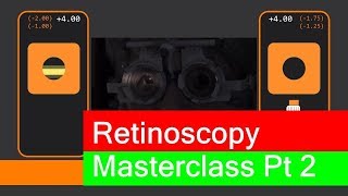 Retinoscopy Masterclass Part 2 [upl. by Ruprecht183]