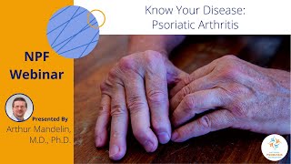 Know Your Disease Psoriatic Arthritis [upl. by Lenssen91]