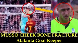 Juan Musso Fractured Cheekbone  Expert discusses Atalanta Goal Keeper Musso fractured cheekbone [upl. by Viking]