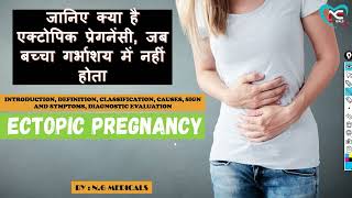 Ectopic Pregnancy part 1  FULL EXPLANATION IN HINDI BY NG MEDICALS [upl. by Enyleuqcaj]