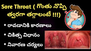 Sore Throat in Telugu గొంతు నొప్పి [upl. by Osmond]