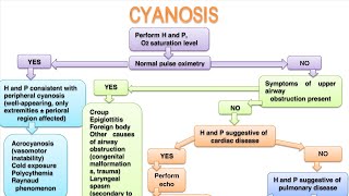 CYANOSIS In pediatrics [upl. by Verine234]