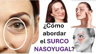 ¿Como abordar el surco nasoyugal [upl. by Fini]