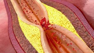 All you need to know about your endothelium [upl. by Vern418]