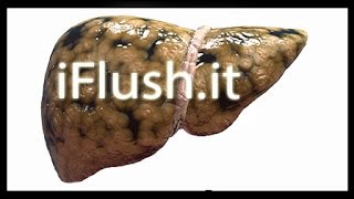 ♥ ♥ ♥ FATTY LIVER DIET RECIPES ♥ ♥ ♥ Alkalizing ♥ Electrolyte Snack ♥ Recipe [upl. by Gayelord]