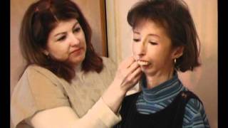 Scleroderma the Teresa Nadeau Story part 4mp4 [upl. by Ilrak]