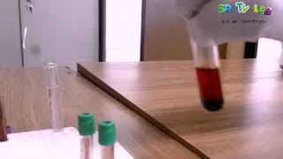 What is hemolysis hemolysis experiment using water [upl. by Zaob]