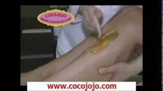 Sugaring Hair Removal  Different techniques to Do Sugaring Hair Removal [upl. by Seow]