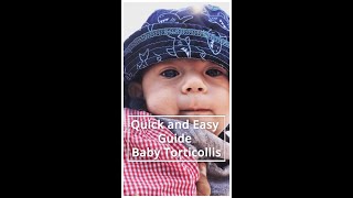 5 Signs Your Baby May Have Torticollis Quick And Easy Guide [upl. by Aikemal]