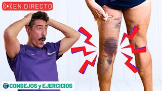 🔴 Mi experiencia con Roturas musculares  ejercicios y consejos 🔴 V [upl. by Lledrac251]