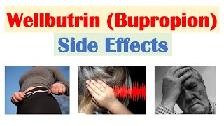 Wellbutrin Bupropion Side Effects To Watch Out For amp Why They Occur [upl. by Farlee]