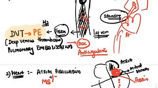 Hematology  AntiCoagulants [upl. by Ahsytal]