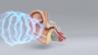 Explore the Science of Hearing Loss  MiracleEar Hearing Center [upl. by Canale]