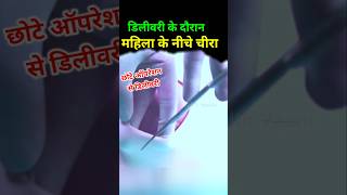 Normal delivery में छोटा ऑपरेशन chotaoperation episiotomy [upl. by Sehcaep]