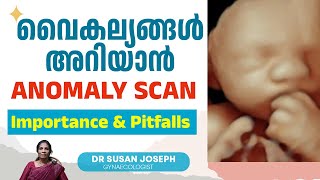 വൈകല്യങ്ങൾ 100 അറിയാൻ പറ്റുമോ അനോമലി സ്കാനിൽ  DRSUSAN JOSEPH [upl. by Nairrot]