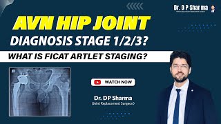 Diagnosis of AVN Hip XrayMRI Stage 123 Ficat and Artlet Classification amp Treatment In Delhi NCR [upl. by Newel729]