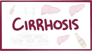 Cirrhosis  causes symptoms diagnosis treatment pathology [upl. by Anirdnaxela]