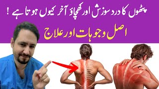 Myalgia Muscle Pain Treatment In Urdu Hindi  Dr Irfan Azeem [upl. by Skylar]