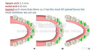 Guidelines for key implant positions [upl. by Nirrej]