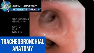 Flexible Bronchoscopy Introduction 7  Airway Inspection Tracheobronchial Anatomy [upl. by Crim994]