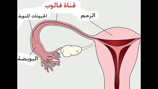 التهاب قناة فالوب دمحمد جاد Acute Salpingitis DRJAAD [upl. by Mozza]