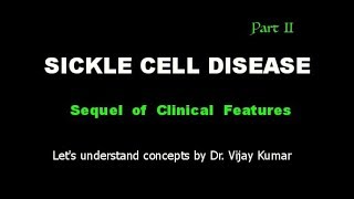 Symptoms In SCD  Sickle Cell Disease  सिकल सेल रोग [upl. by Notsag]