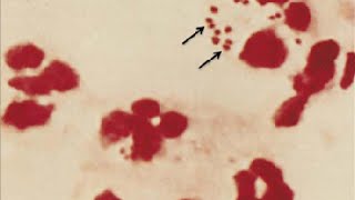 Medical Index  Aerobic Gram Neg Diplococci and Coccobacilli [upl. by Jamnis72]